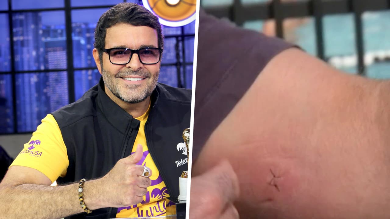 ¿A Pablo Montero le ha funcionado el chip que se implantó para no consumir alcohol?