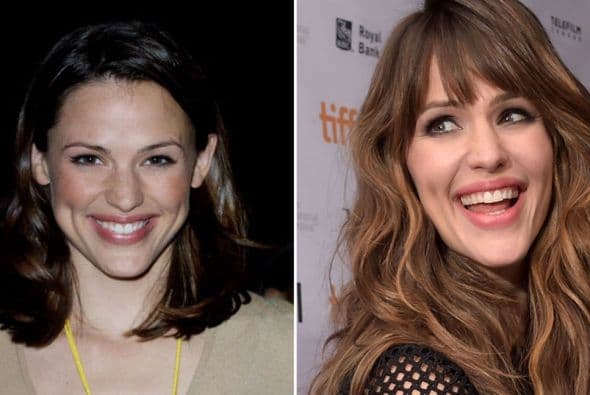 Ahora la hermosa actriz ya no luce unas encías prominentes.