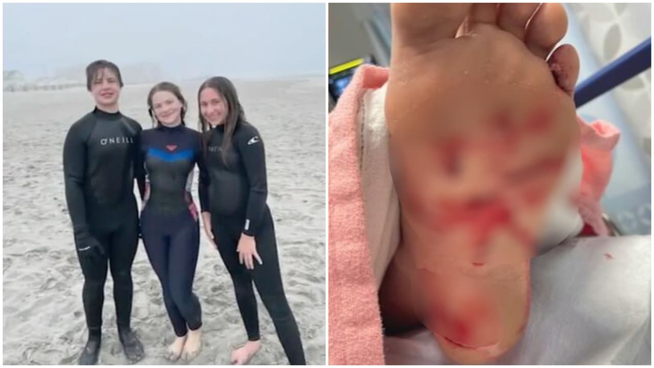 Adolescente sobrevive a mordedura de tiburón mientras surfeaba en Stone Harbor, Nueva Jersey