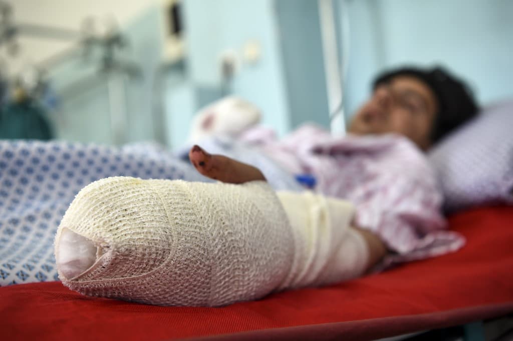 El atentado ocurrió la víspera del centenario de la independencia de Afganistán. "Los participantes bailaban y festejaban cuando se produjo la explosión", explicó un testigo que tiene heridas en brazos y abdomen.
<br>
<br>