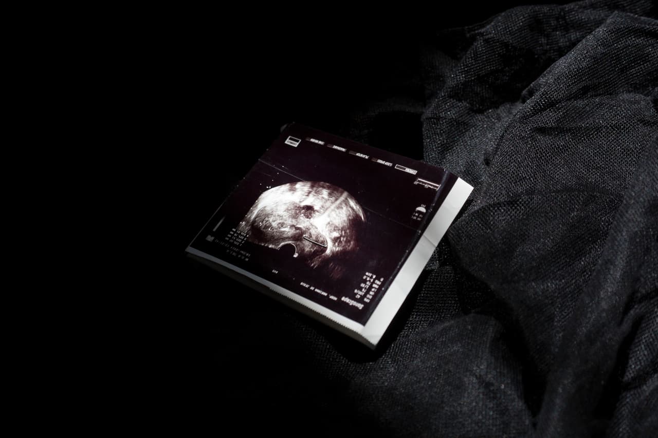 Más recuerdos: una ecografía que acompañaba el viaje de alguna persona.