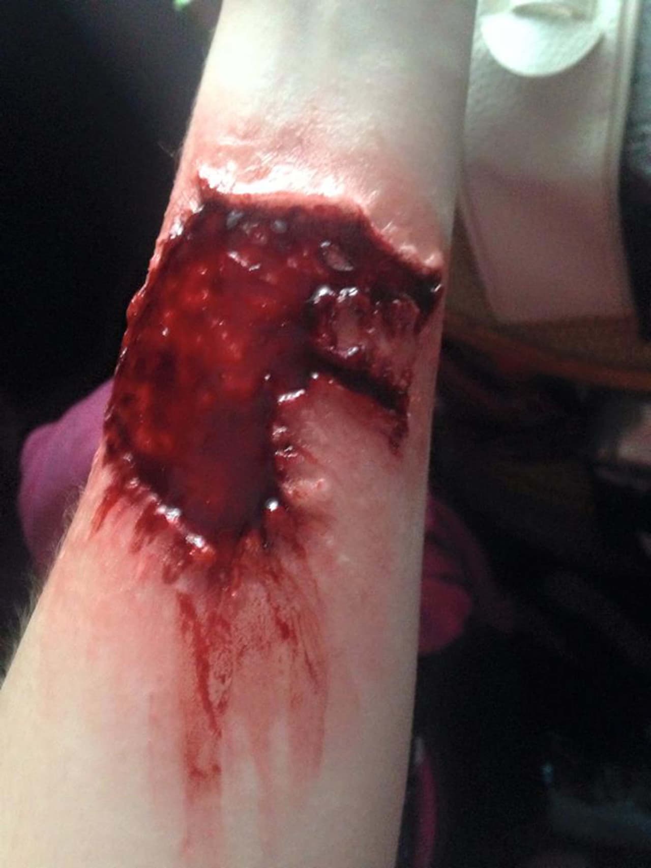 ¡Uy! Si esa herida fuera real, cualquiera sentiría profundo dolor.