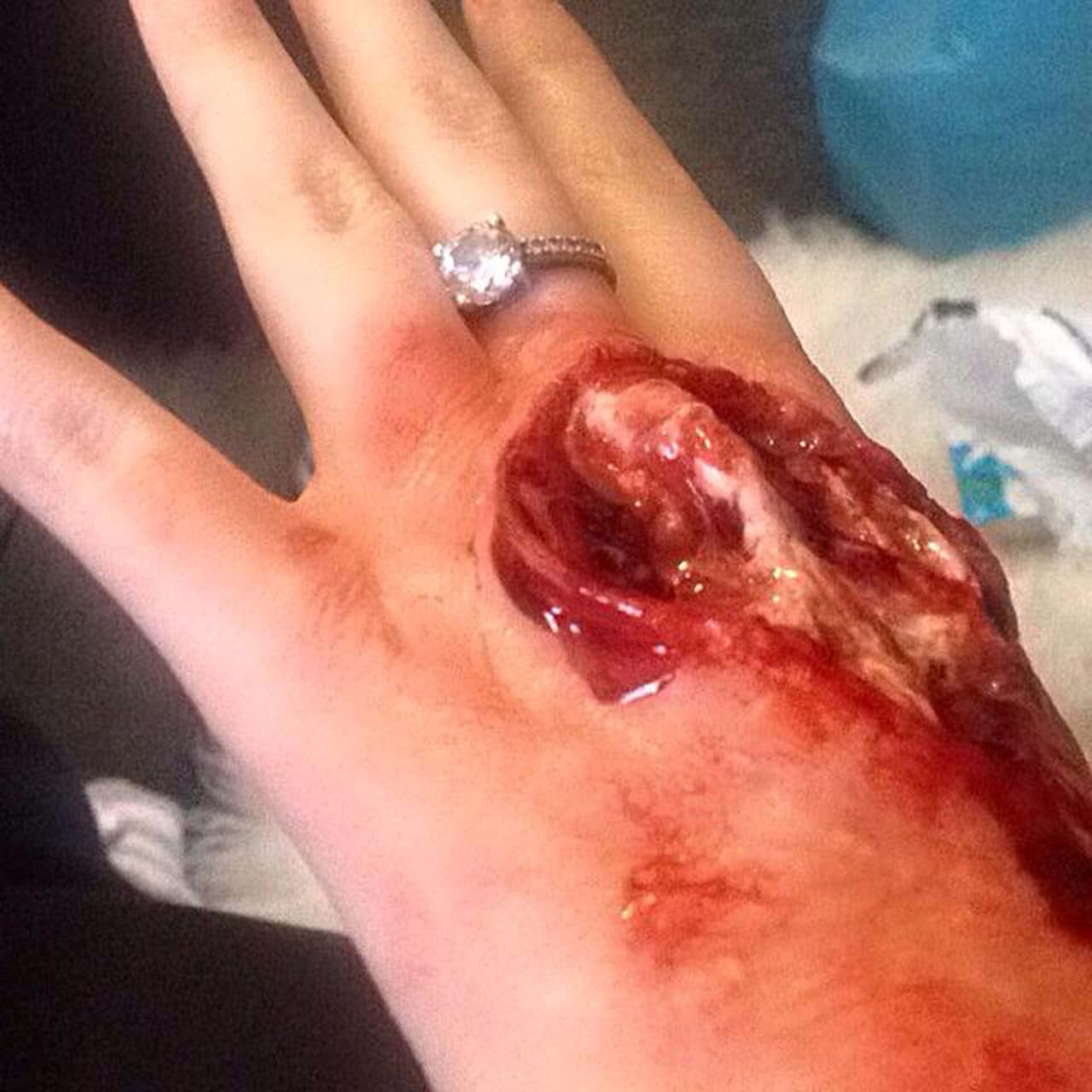 Le gustaba usar materiales para fingir heridas y espantar a su mamá.