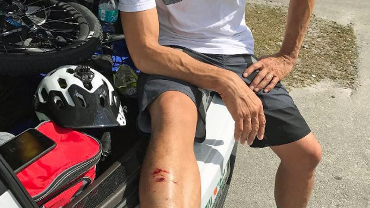 Un tronco en el camino provocó que Johnny perdiera el control de la bicicleta.