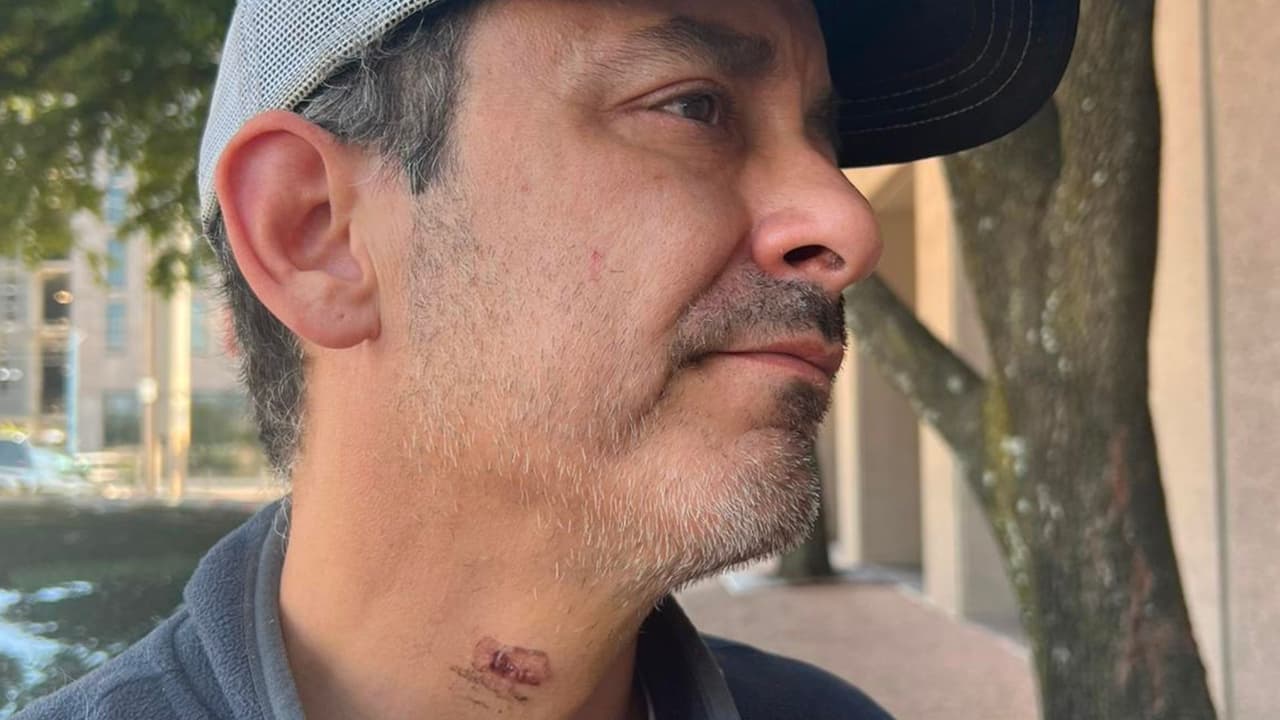 Joshua nos enseña la herida en su garganta, a tan solo unos centímetros de su vena yugular.