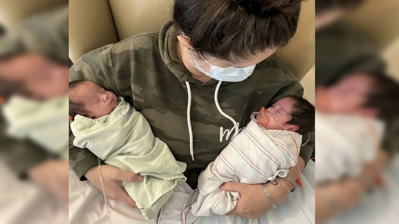 Salvan la vida a gemelos prematuros que nacieron con un problema grave de corazón con una novedosa técnica 