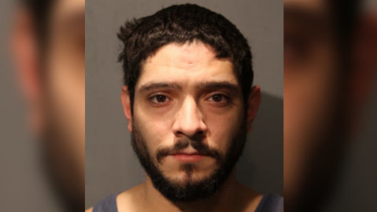 Moretones, costillas rotas y otras heridas fueron halladas por médico forense en bebé asesinado, presuntamente, por su padre