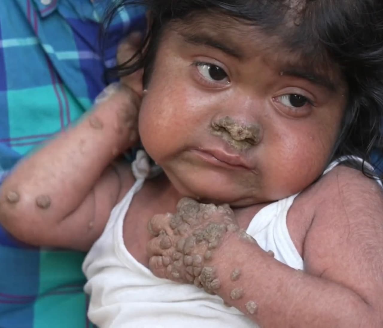 Cuando llegó la hora de pedir un deseo, Astrid no titubeó: “medicina para curarme”.
<br>