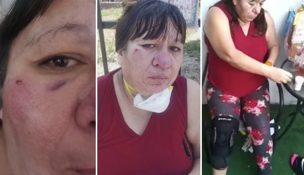 <a href="https://www.univision.com/local/los-angeles-kmex/ya-no-quiero-vivir-aqui-esto-es-lo-que-se-sabe-sobre-ataque-a-vendedoras-ambulantes-en-los-angeles">Marisela Cuevas y su hija María fueron golpeadas y asaltadas</a> cuando se ganaban la vida, su ataque ya forma parte de múltiples agresiones hacia vendedores ambulantes hispanos en tiempos del coronavirus en Los Ángeles.