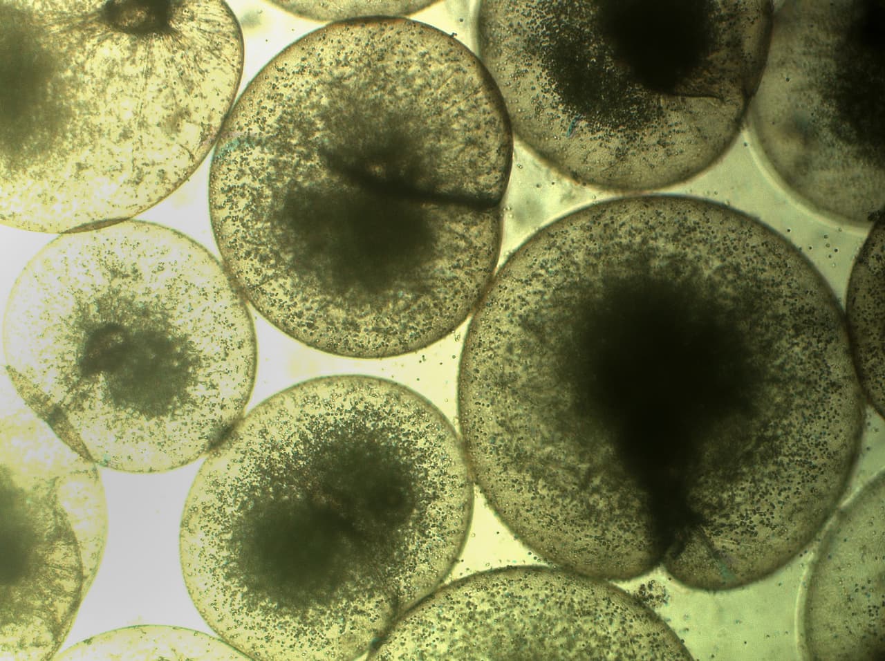 Así se ven las algas bajo el microscopio del biólogo marino Khalid al-Hashmi en la Universidad Sultan Qaboos en Omán. Al-Hashmi ha registrado personalmente el meteórico crecimiento de estas algas. (Khalid al-Hashmi vía AP)