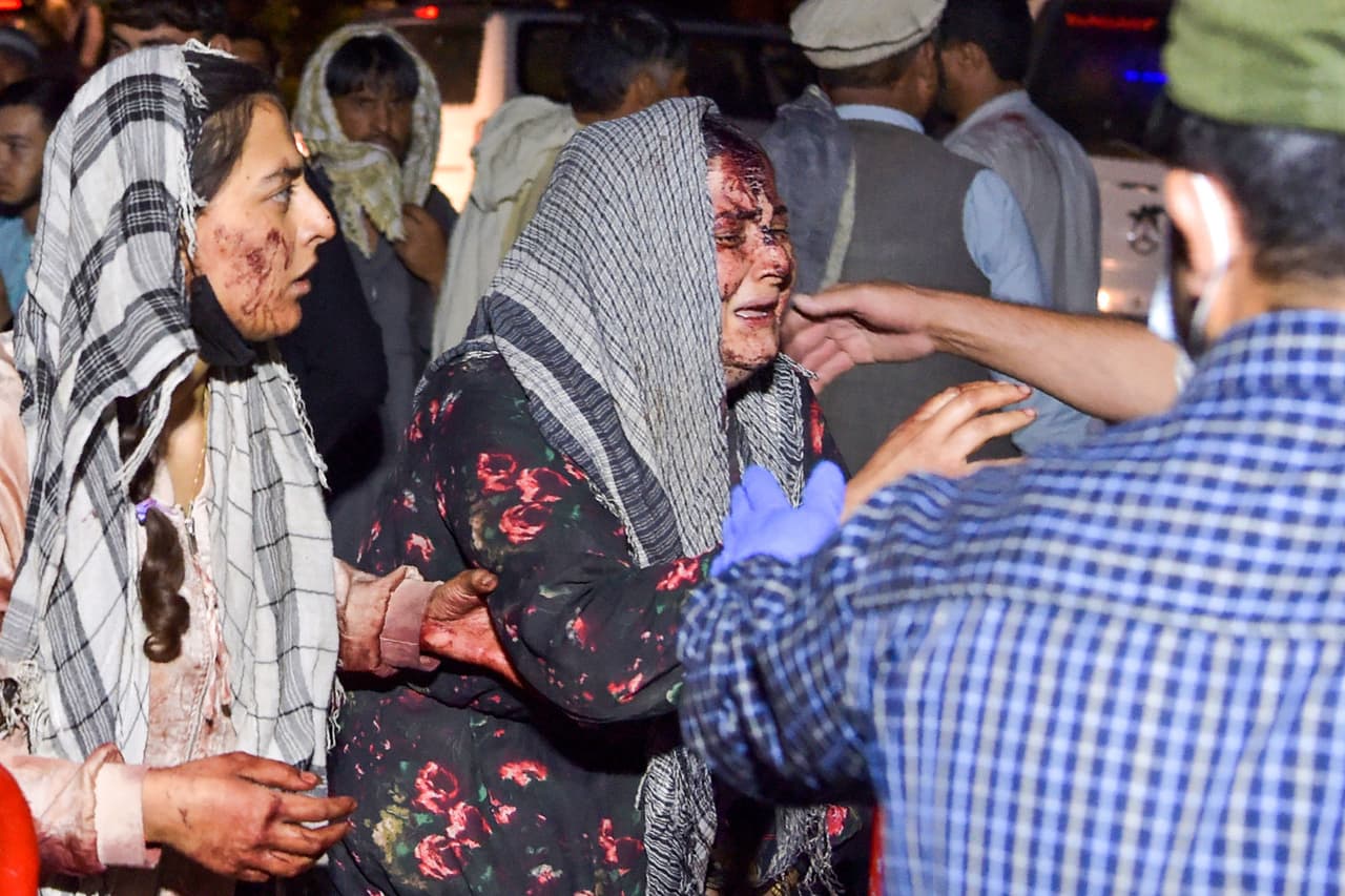 Una mujer herida llega a un hospital de Kabul luego de las dos explosiones ocurridas en en esa ciudad el 26 de agosto. El portavoz del Pentágono, John Kirby, confirmó que hubo "varias" víctimas estadounidenses y civiles en los atentados.