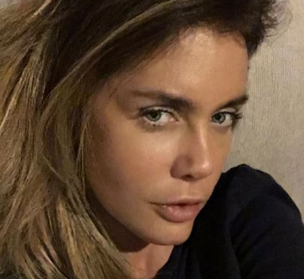 "[...] Es una operación, es un reemplazo de cadera, entonces, no es como que sean enchiladas. Yo creo que en unas dos semanas regreso (al hospital) para que me hagan un chequeo [...]".