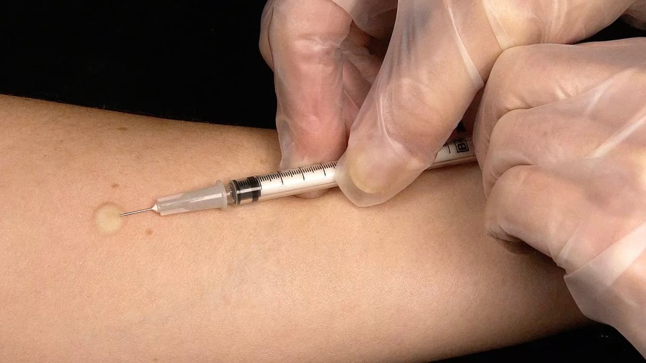 "Vacuna de la tuberculosis podría funcionar contra el coronavirus": investigadores de Houston