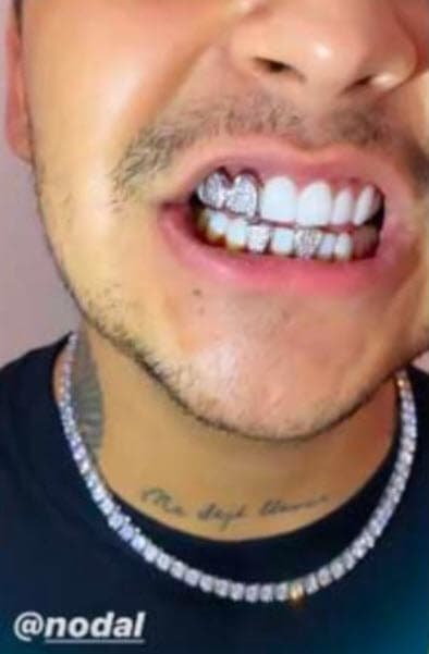 Nodal ha presumido también su dentadura de diamantes.