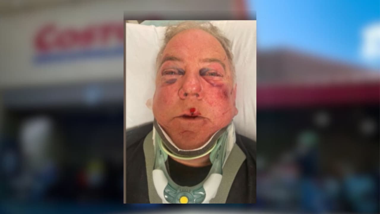 Por un estacionamiento, agreden brutalmente a un hombre en Costco de Danville