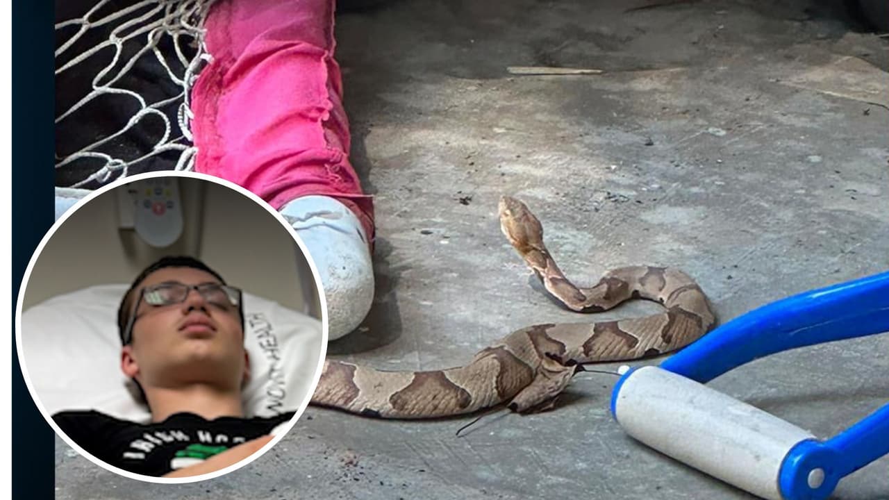 Niño de 14 años es mordido por serpiente cabeza de cobre mientras jugaba en su casa 