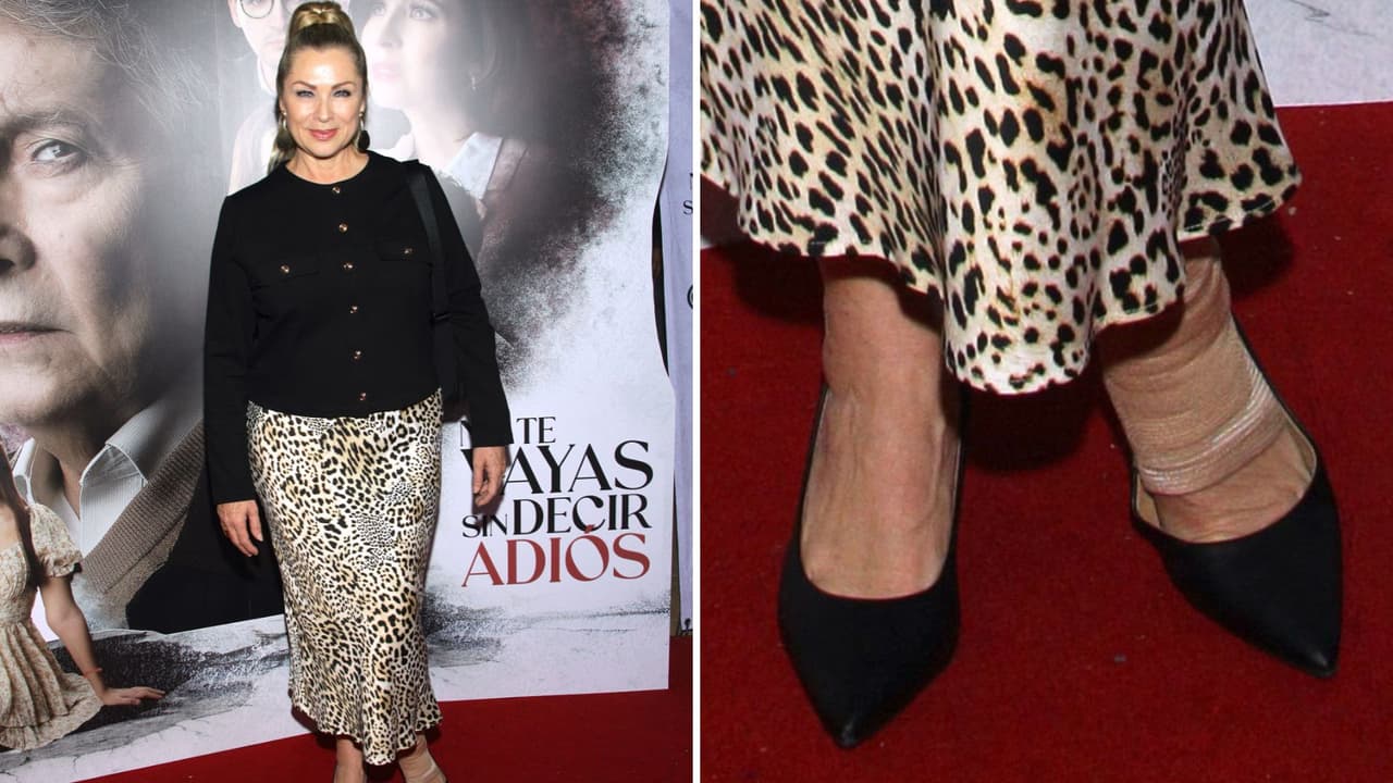 Leticia Calderón lleva el pie vendado.