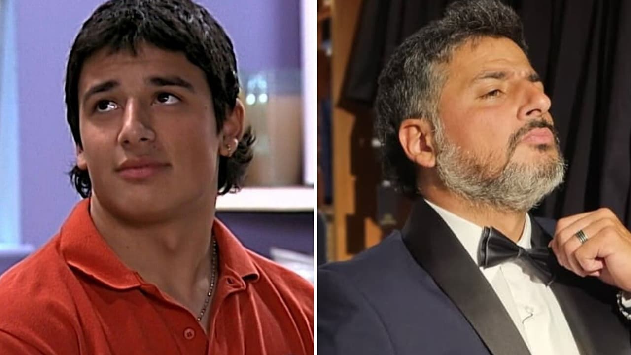 Actor de ‘Rebelde Way’ pierde un ojo en accidente: será trasplantado 11 años después