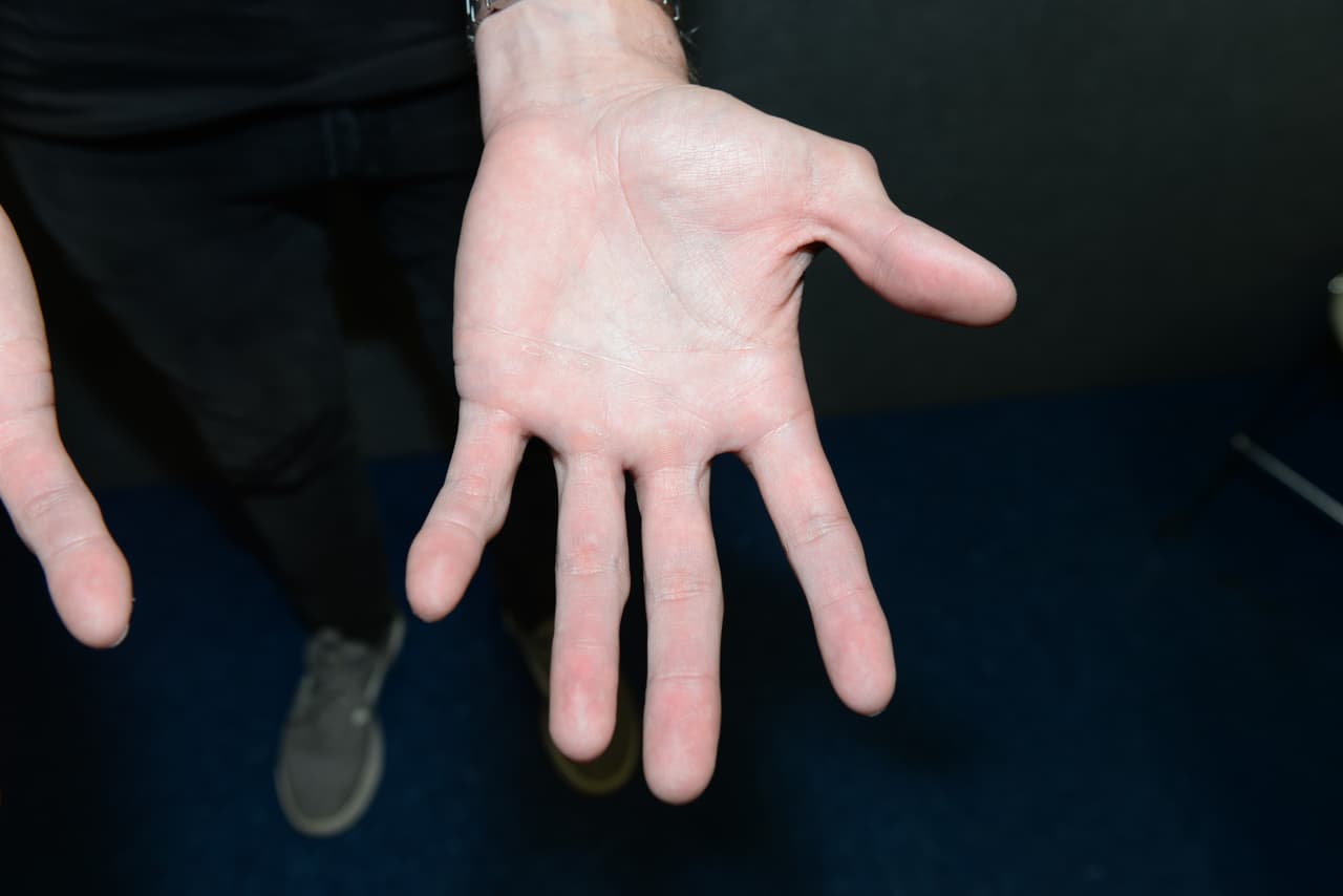 Un testigo dijo a la policía que la víctima 
<b>tenía sus manos hacia arriba y le pedía (a Lyle) que parara</b>”.