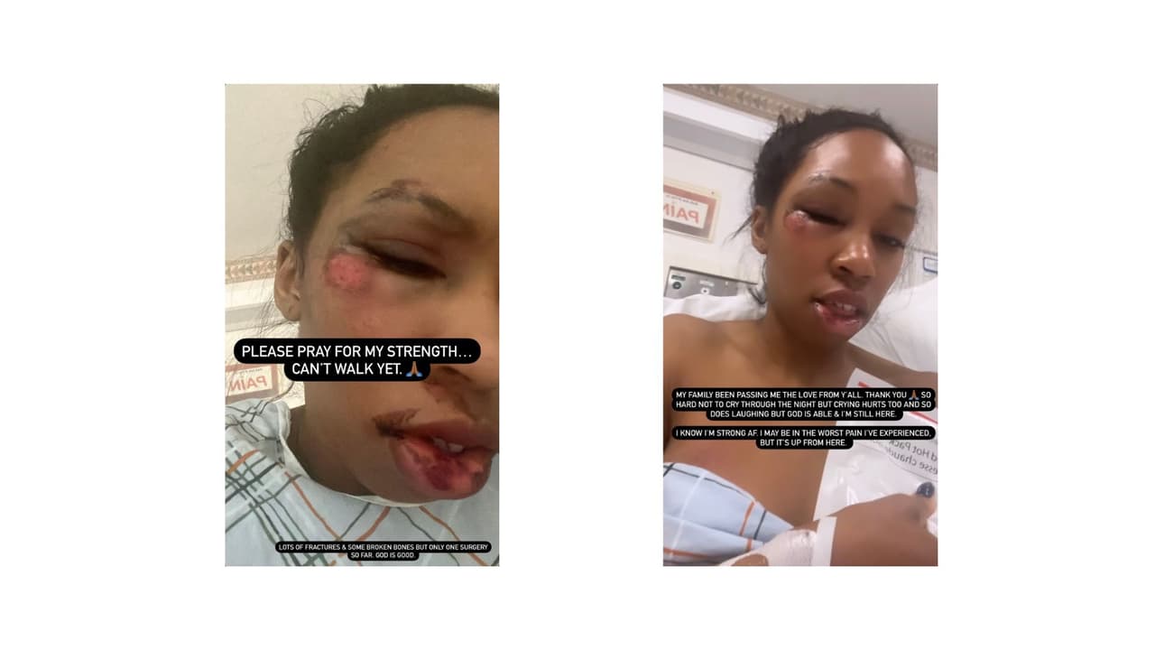 Carrie Bernans ha tratado de alimentar a su bebé de 7 meses tras el brutal accidente.