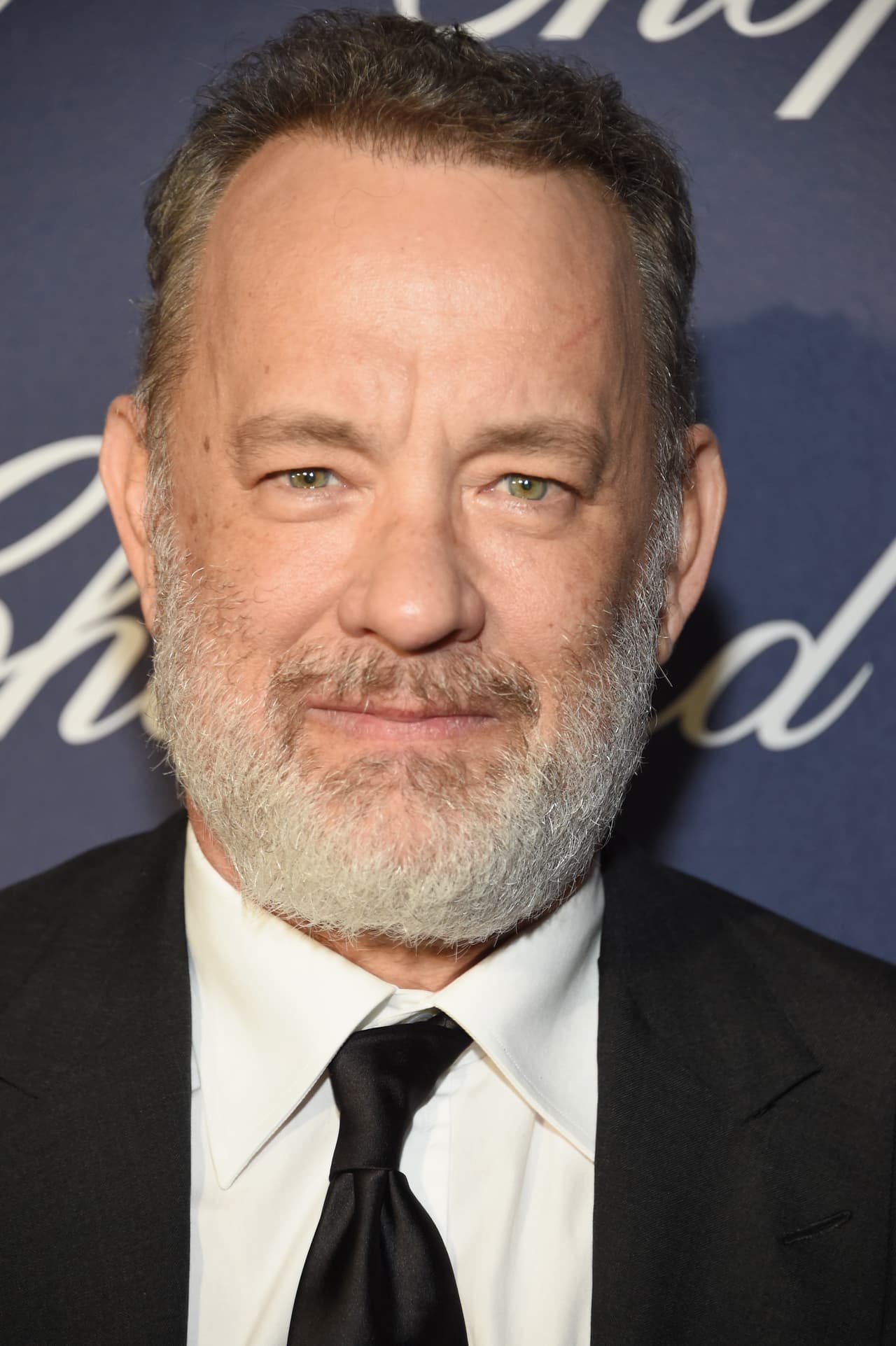 El actor se quedó en el hospital debido a que la infección en sus heridas se estaba extendiendo y, de acuerdo con los médicos, si esta llegaba a la sangre podía acabar con la vida del actor.