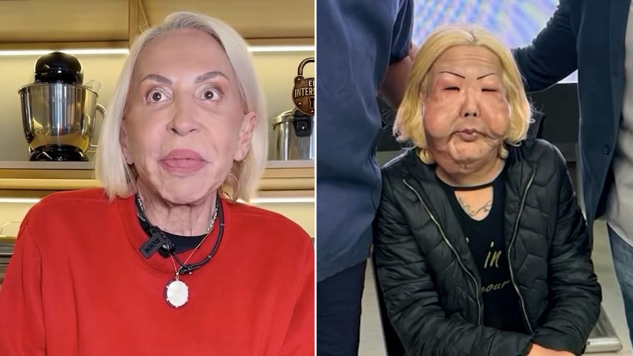 ¿Laura Bozzo “desfigurada” del rostro tras cirugía? La verdad sobre el video viral