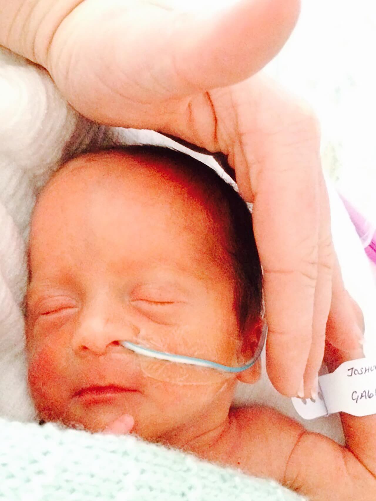 Después de dicha cirugía los bebés lograron sobrevivir y ahora tienen 18 meses de edad.