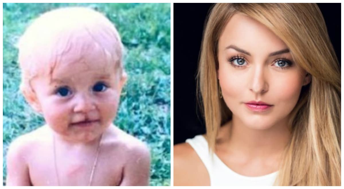 La verdad detrás del supuesto labio leporino de Angelique Boyer (tuvo que doler mucho)