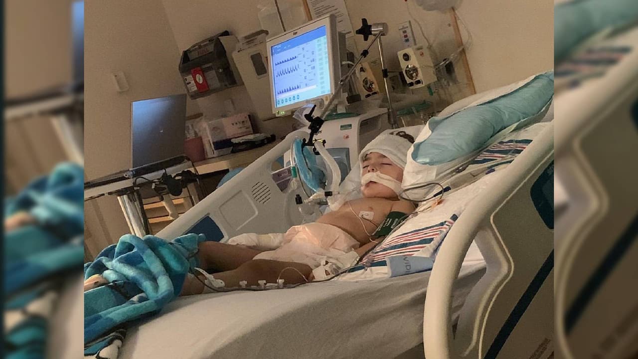 "Tengo la esperanza que sane", bebé de dos años se aferra a la vida tras contraer potente virus respiratorio 
