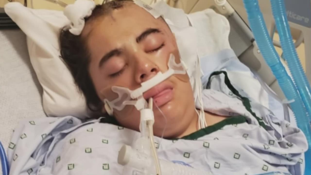 <b>Joven salvadoreño es baleado en la cabeza cuando esperaba a un amigo dentro de su camioneta en Miami</b>
<br>
<br>Justin Acevedo cumplió 18 años intubado en la sala de cuidados intensivos de un hospital después de ser baleado en la cabeza. En el momento del ataque él se encontraba frente a un complejo de apartamentos esperando a un amigo en su camioneta. El joven está en coma inducido. Su madre, entre lágrimas, pide justicia y ayuda para encontrar al culpable. "Le quitaron parte del cráneo porque el cerebro se estaba ahogando por mucho sangrado", explicó sobre una operación que le realizaron a su hijo.