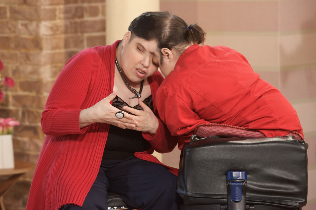 Lori y George Schappell fueron los gemelos siameses más longevos del mundo.