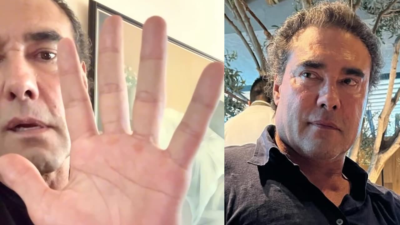 Eduardo Yáñez revela cuál enfermedad padece tras rumores de que tiene Parkinson