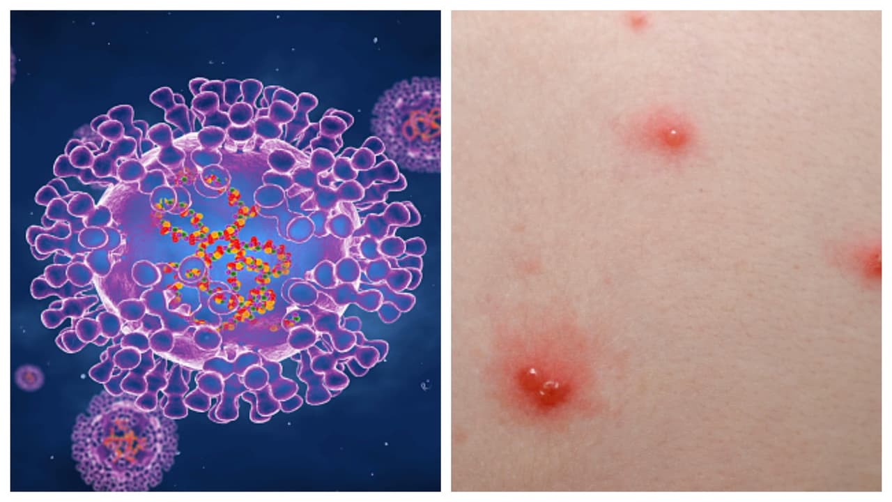 El caso está relacionado con un hombre que estaba en un viaje internacional.