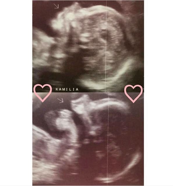 Gredmarie compartió el sonograma 4D de su adorada baby Kamilia