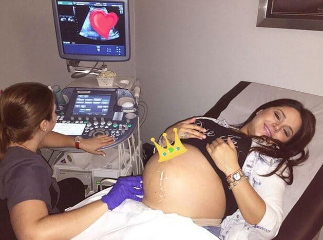 En Rubén & Co pudimos ver en 4D a #BabyCompany, la pequeña Kamilia que está en la barriguita de Gredmarie