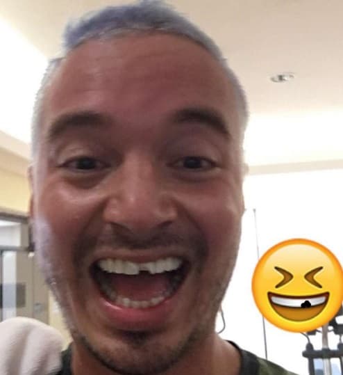 Tan emocionado ha estado estos días que perdió un diente y con un toque de humor dio a conocerla noticia.