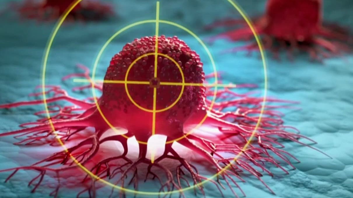 Análisis de sangre puede lograr la detección temprana de cáncer; especialista explica características