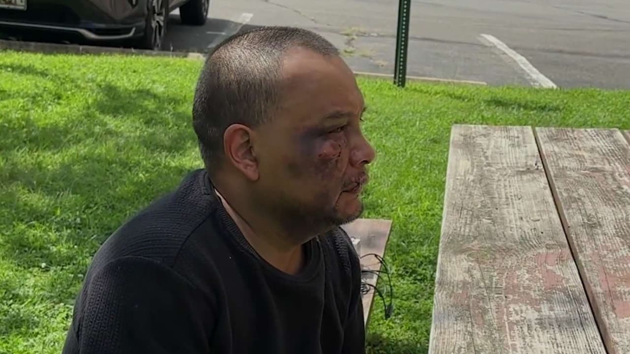 Denuncian tortura contra José Mejía durante cita médica bajo custodia migratoria
