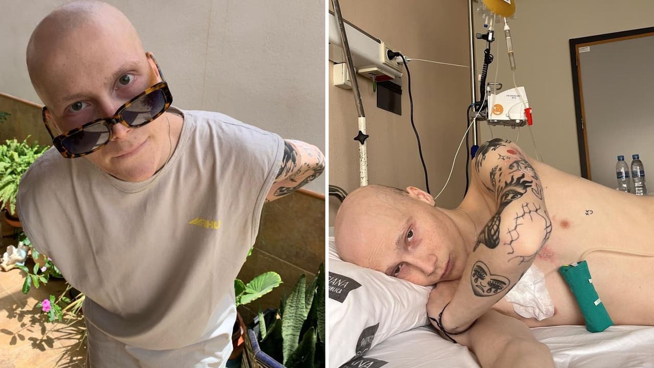 Conquistó TikTok gracias a que enfrentaba el cáncer con humor: conoce la historia de Charlie