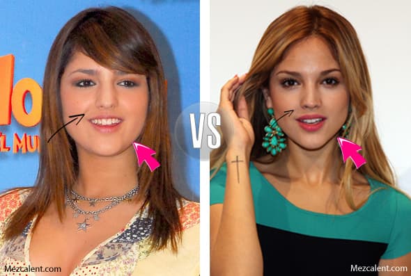 Es bien sabido que Eiza González se ha hecho más de una operación en el rostro.