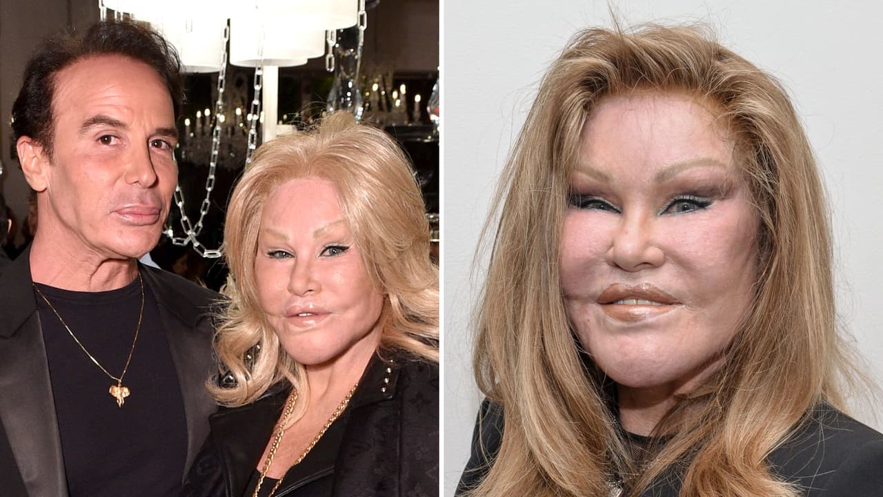 Lloyd Klein, pareja de Jocelyne Wildenstein, compartió cómo fueron sus últimos momentos de vida.