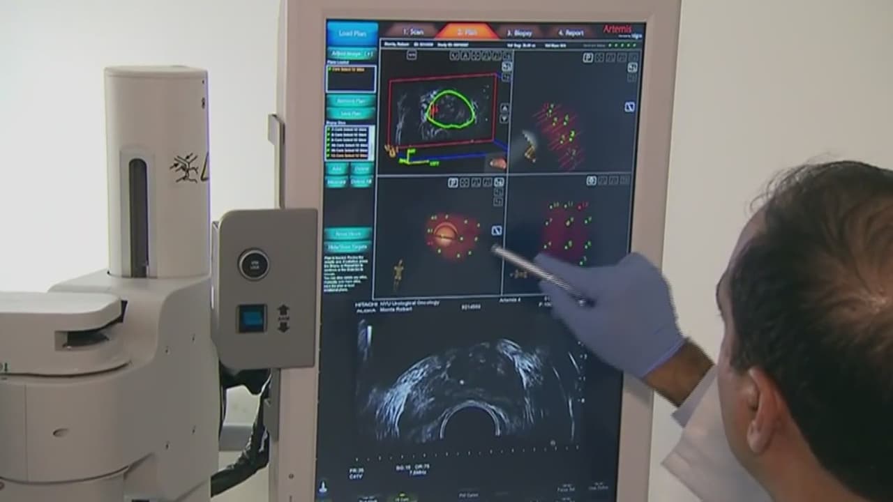 Cáncer de colon lidera muertes en hombres menores de 50 años en EEUU