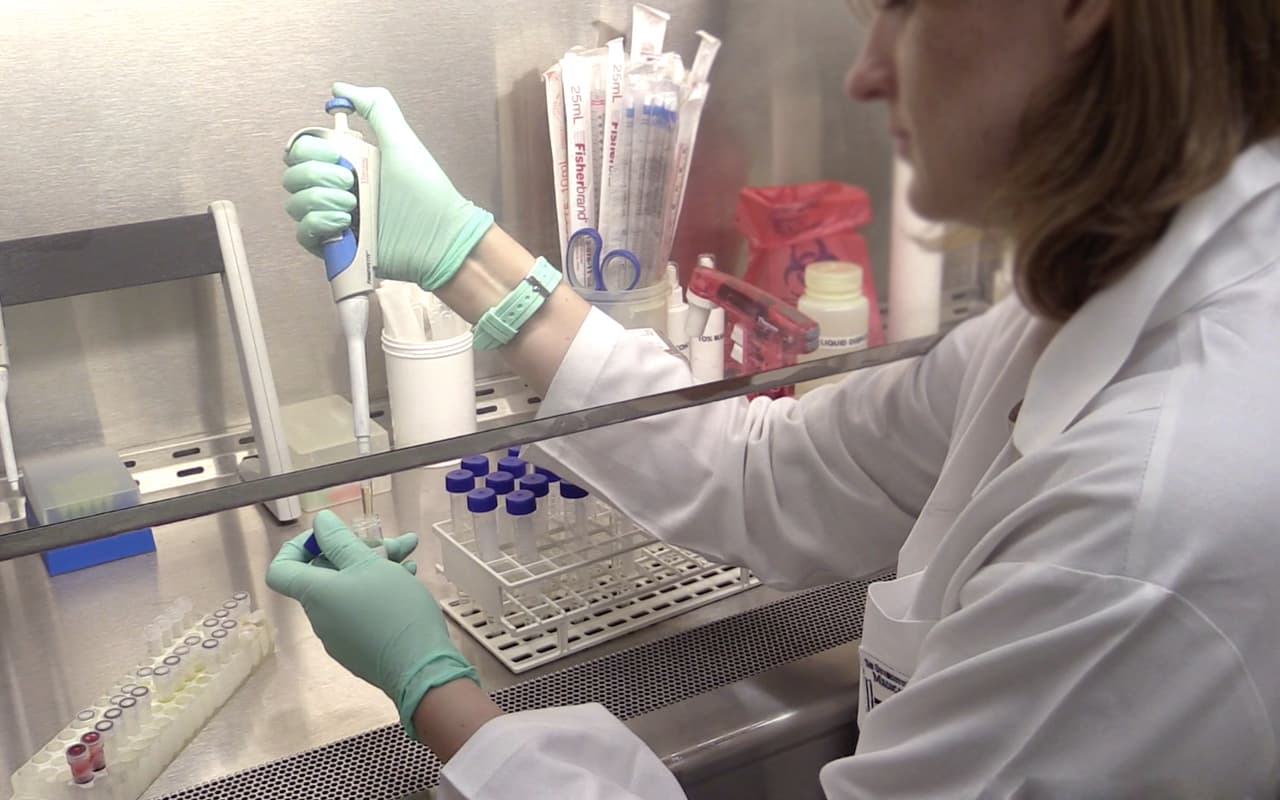 El virus del SIDA está controlado pero no vencido