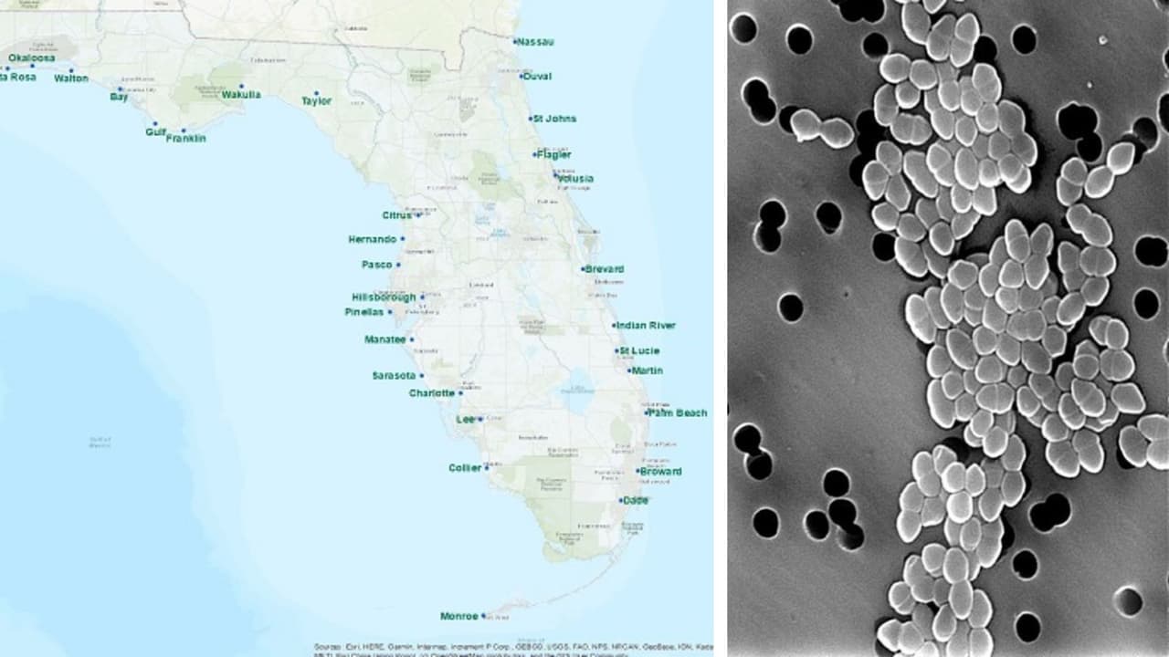 Alerta: Las 8 playas de Florida contaminadas con materia fecal