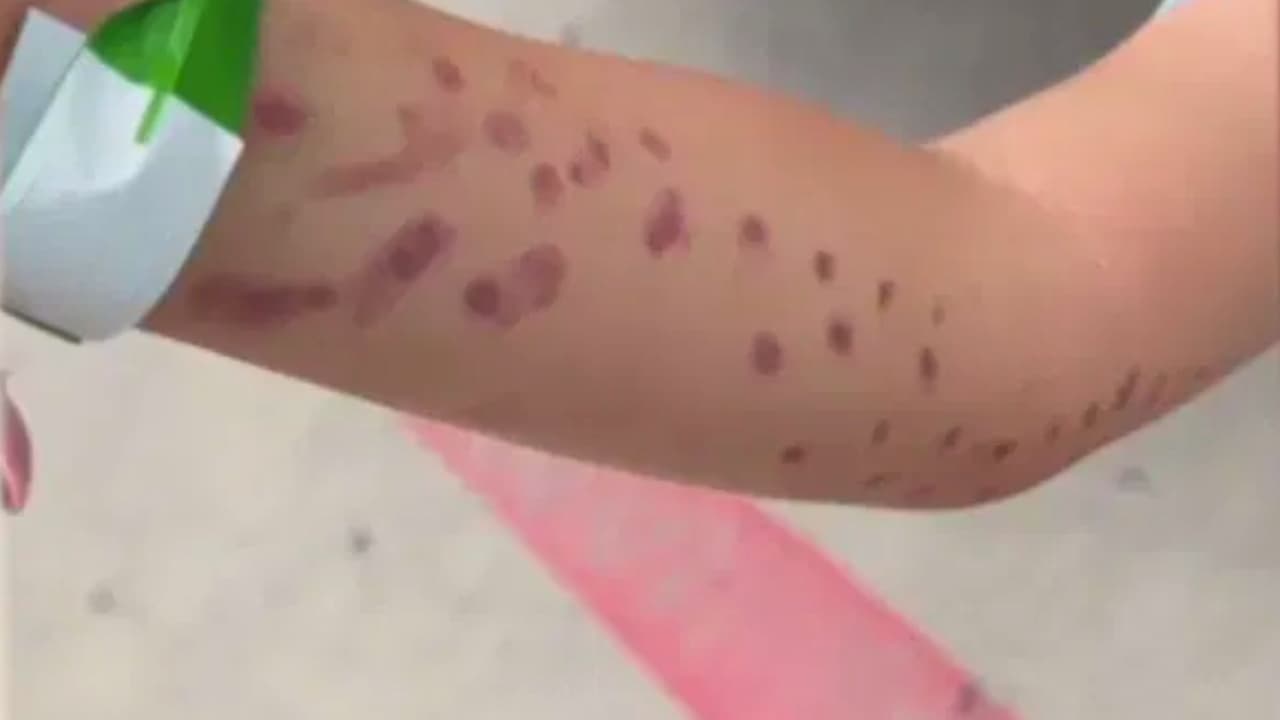 <h3 class="cms-H3-H3">Una criatura fascinante… ¿demasiado? </h3>
<br>
<br>La bióloga Meg Mindlin dijo a 
<i>NBC News que</i> 
<b>los pulpos exploran su entorno con sus brazos y utilizan sensores de sabor en sus ventosas para interpretar lo que los rodea</b>. Es decir: su manera de conocer el mundo también puede dejar moretones. 
<b>“Podría morderme si quisiera. Pero no soy su comida”</b>, dijo la empleada del acuario en el video, mientras alimentaba al pulpo con camarones. El problema, según la madre de Leo, es que 
<b>nadie le explicó eso antes de permitir que su hijo metiera el brazo al tanque</b>. Ella insiste en que su objetivo 
<b>no es generar pánico</b>, sino advertir que lo que 
<b>para algunos niños puede ser una experiencia educativa, para otros puede ser aterrador.</b>