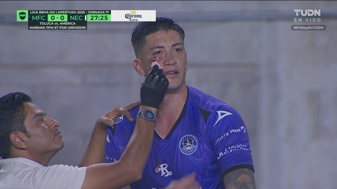 ¡Impresionate golpe! Merolla sufre tremendo corte en la cara