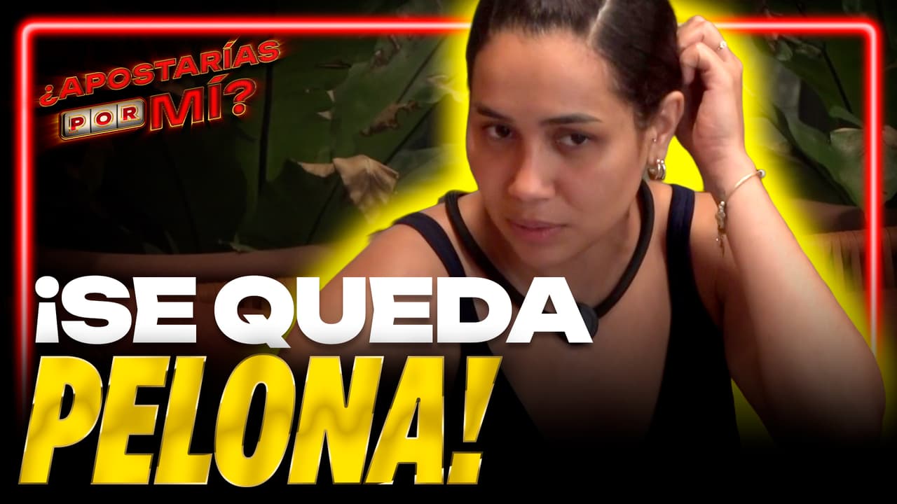 Tiby esta PERDIENDO CABELLO por el ESTRÉS de La Villa