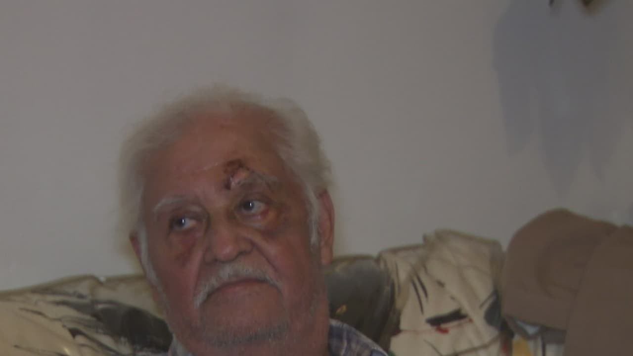 Anciano narra cómo sobrevivió a una brutal golpiza en el tren 