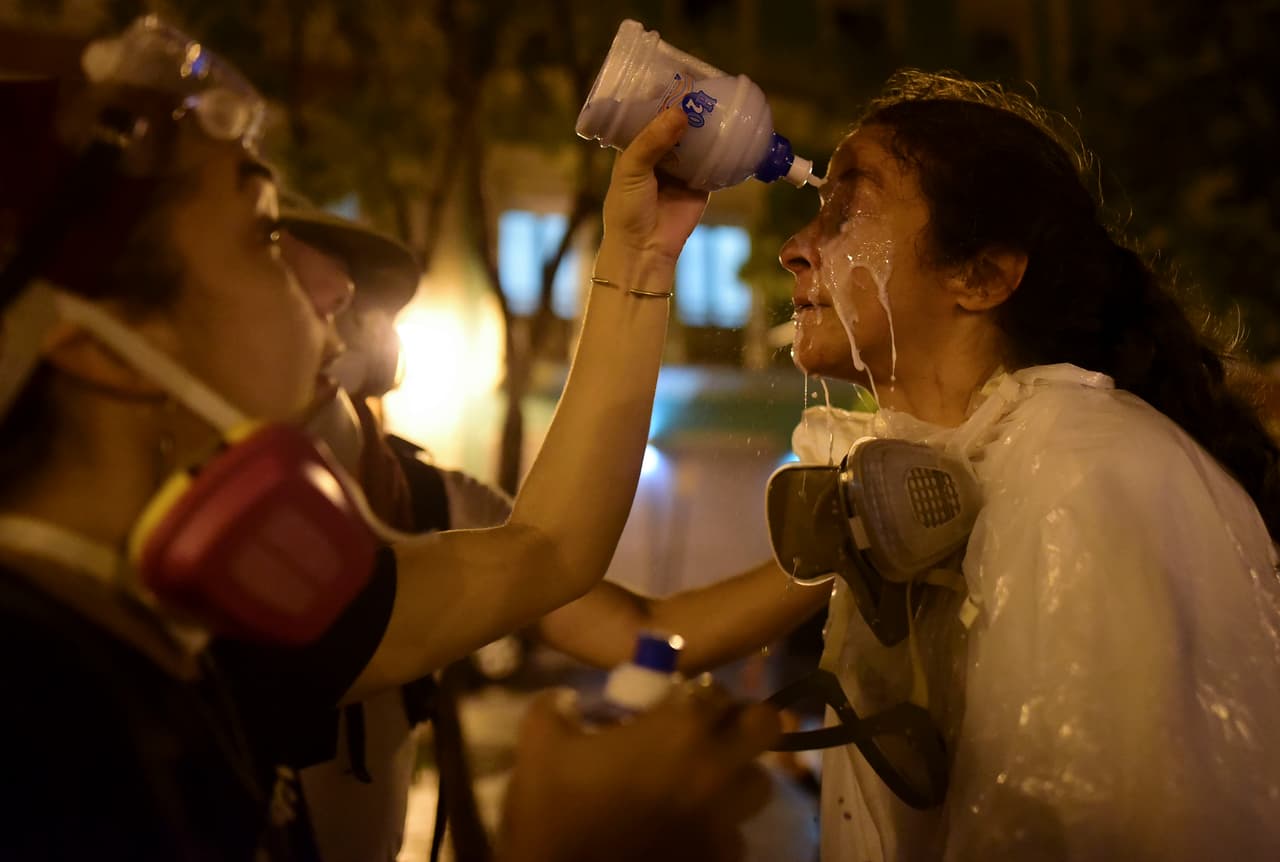 La fotoperiodista Ana María Abruña recibe una solución casera luego de ser expuesta a gases lacrimógenos durante las protestas.
<br>