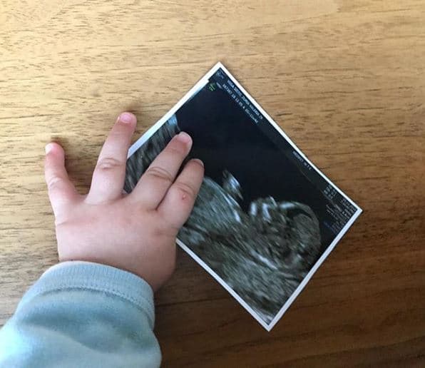 La protagonista de 
<a href="https://www.univision.com/novelas/mi-marido-tiene-mas-familia/capitulos"><b>'Mi marido tiene más familia'</b></a> compartió esta fotografía en su perfil de Instagram. Mostrando la pequeña mano de su hija Lúa con la imagen del bebé que se gesta en su vientre, comentó: "Hola, hermanit@. Bienvenid@ a la familia. Te amamos. Te amo, Alberto Guerra".